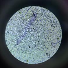 Mikroskopování pokožky listu a průduchů 